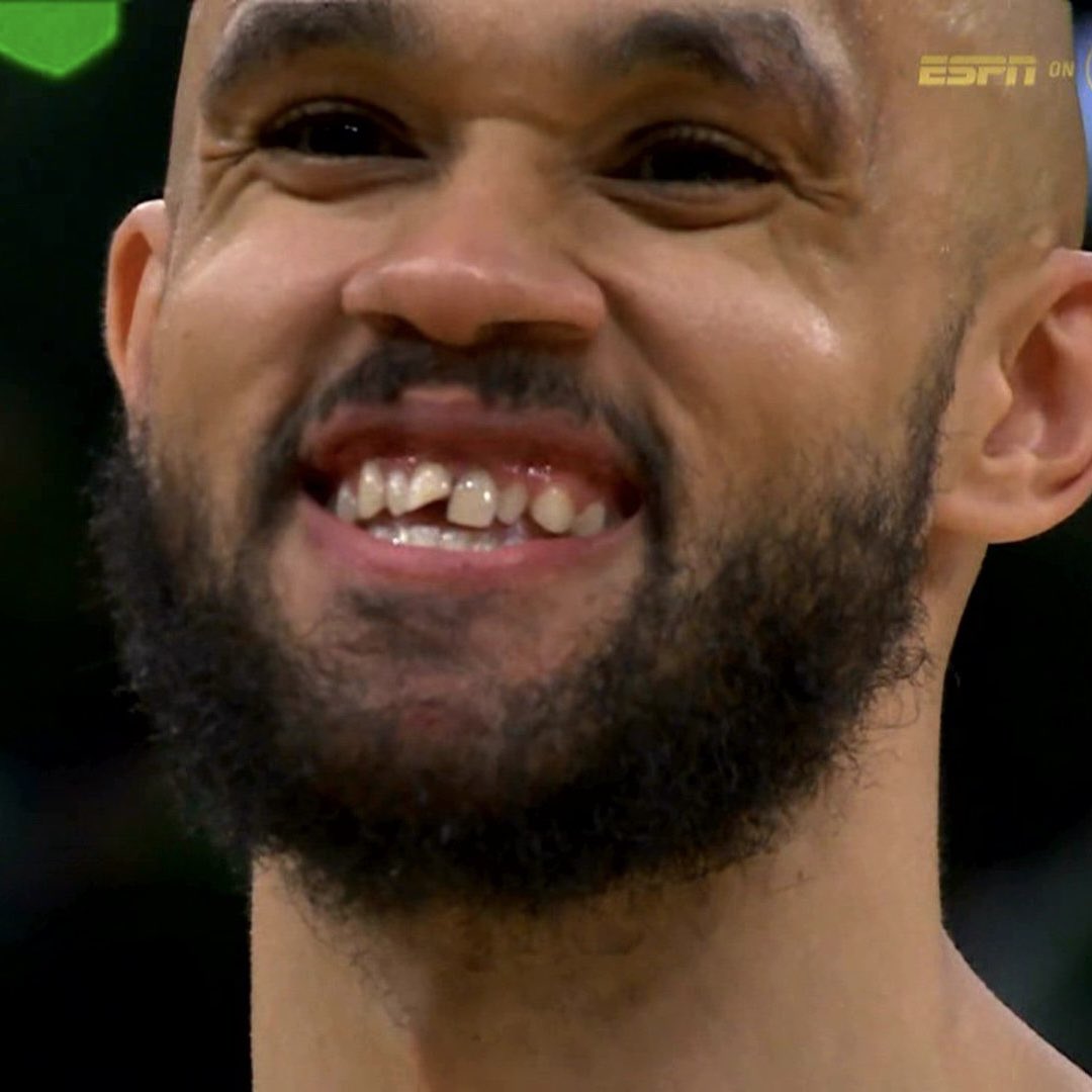 Chipped teeth, full hearts, can’t lose