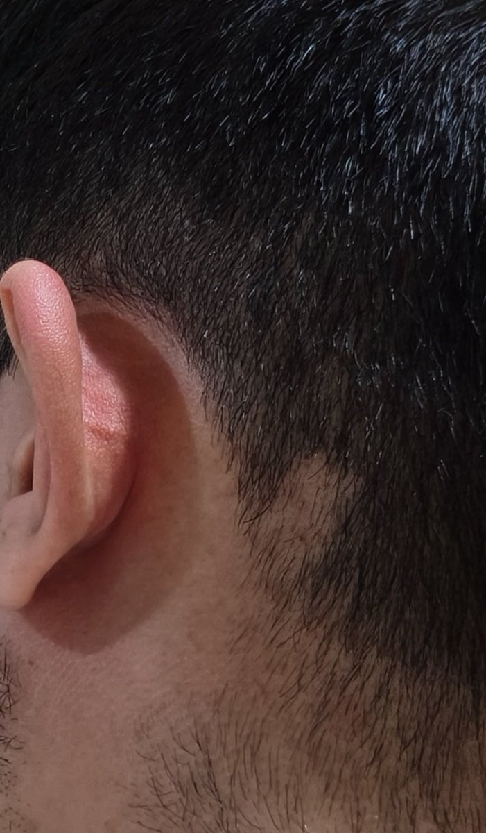 استرس آدمو اینطوری میگاد.
بعد چهار سال باز پشمام ریخت