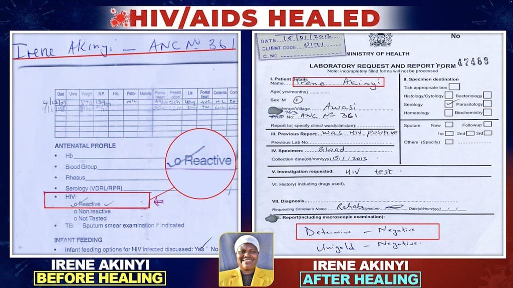 A wonder has happened and we can't be silent on this.The whole world must know that JESUS has healed HIV/AIDS #TopDrRespondsToKEMRI