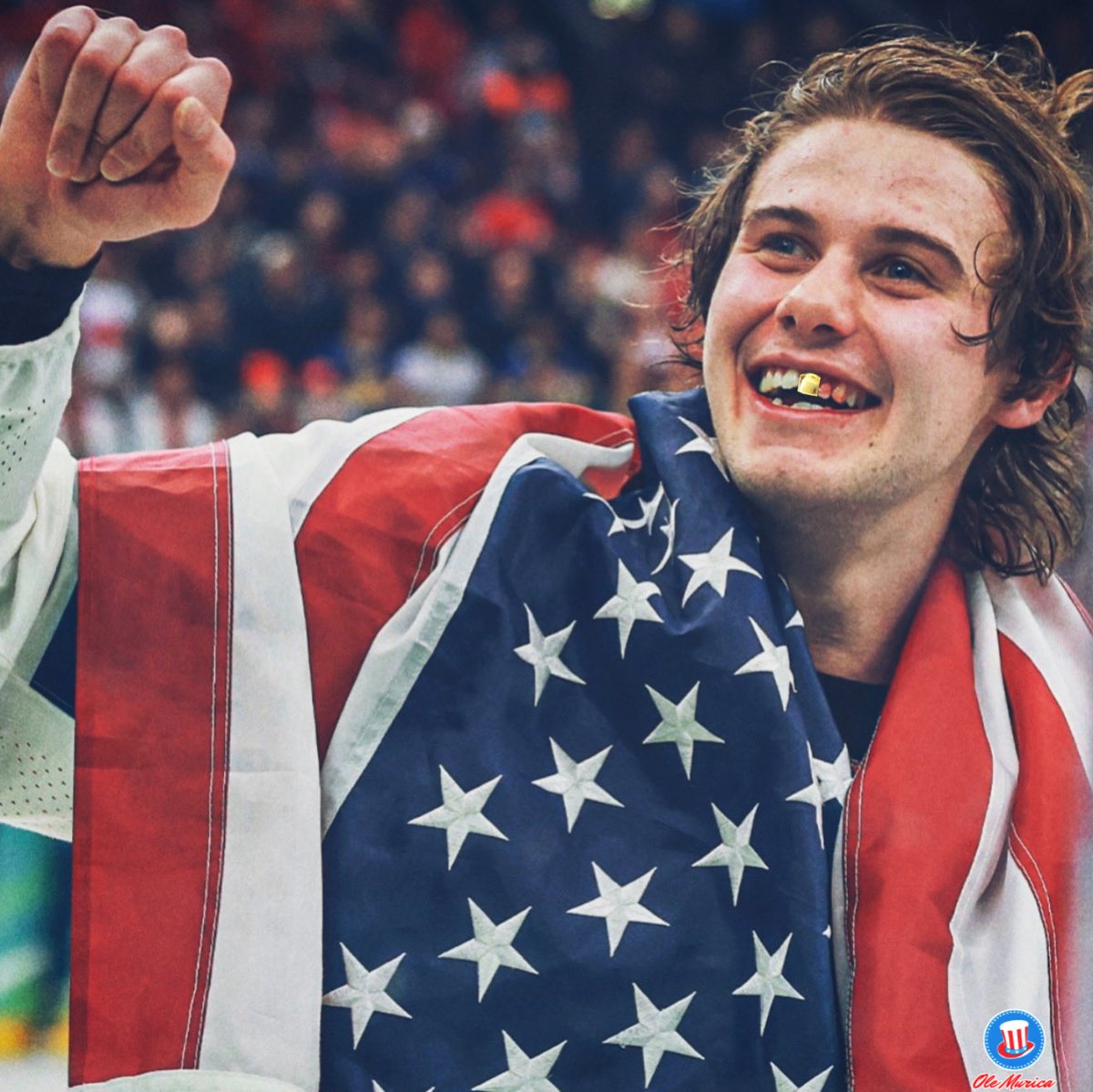 Jack Hughes has to get a Gold Tooth