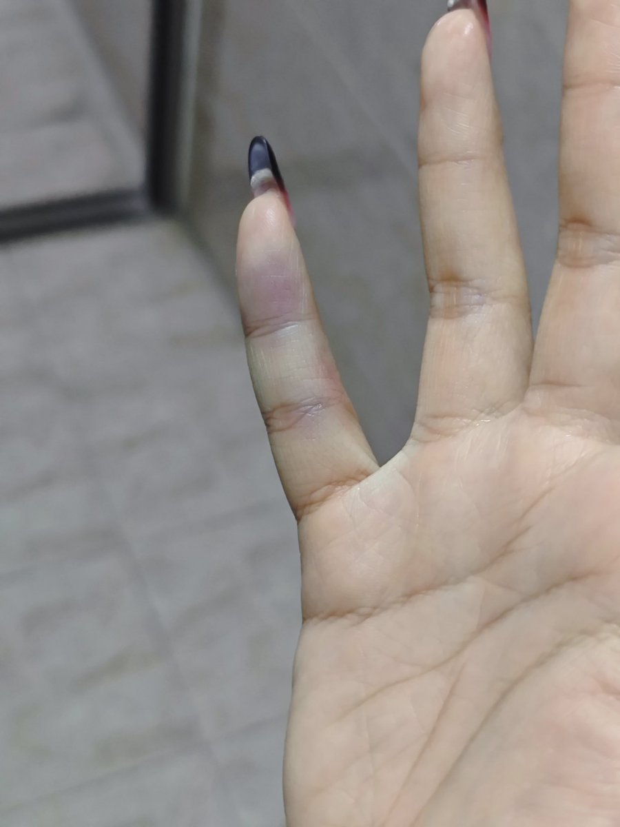 我跟你炸了！ tweet media