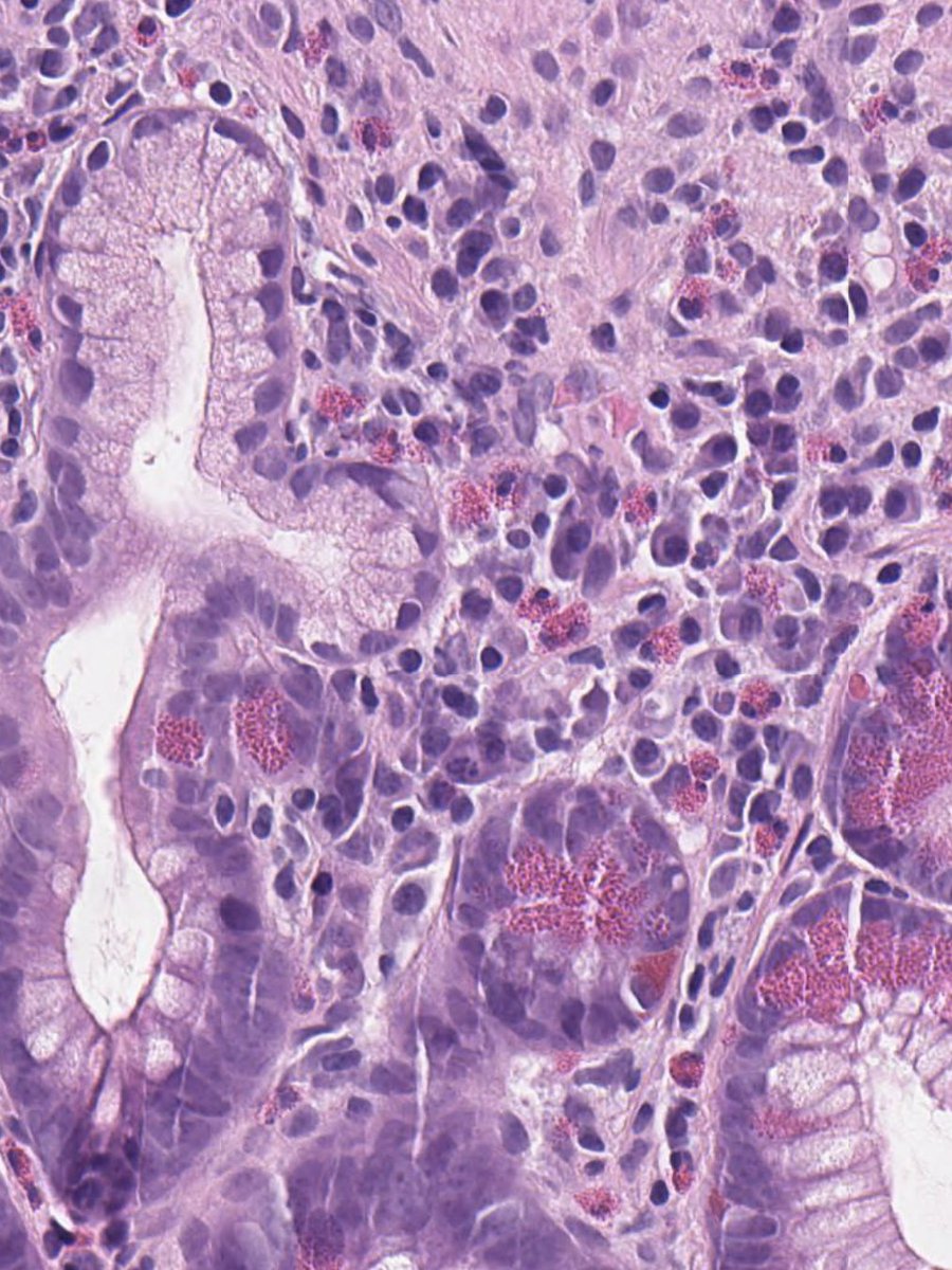 Toby Schmitt, MD tweet media