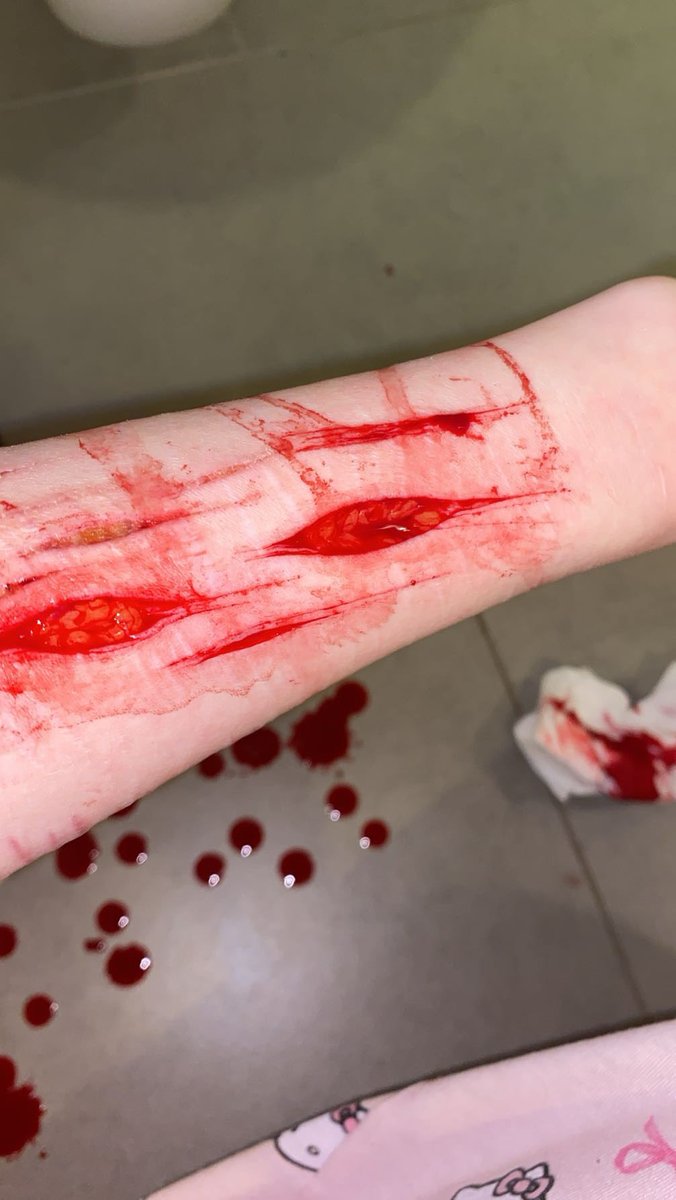 famous_prophett's tweet photo. IM SO SORRY YOU CANT SEE THE FIRST ONE THAT WELL ON THE VID #shtwt #selfharm #shedtwt #beanspo #beans #beanshtwt #slittwt https://t.co/pwQsz9cKIB