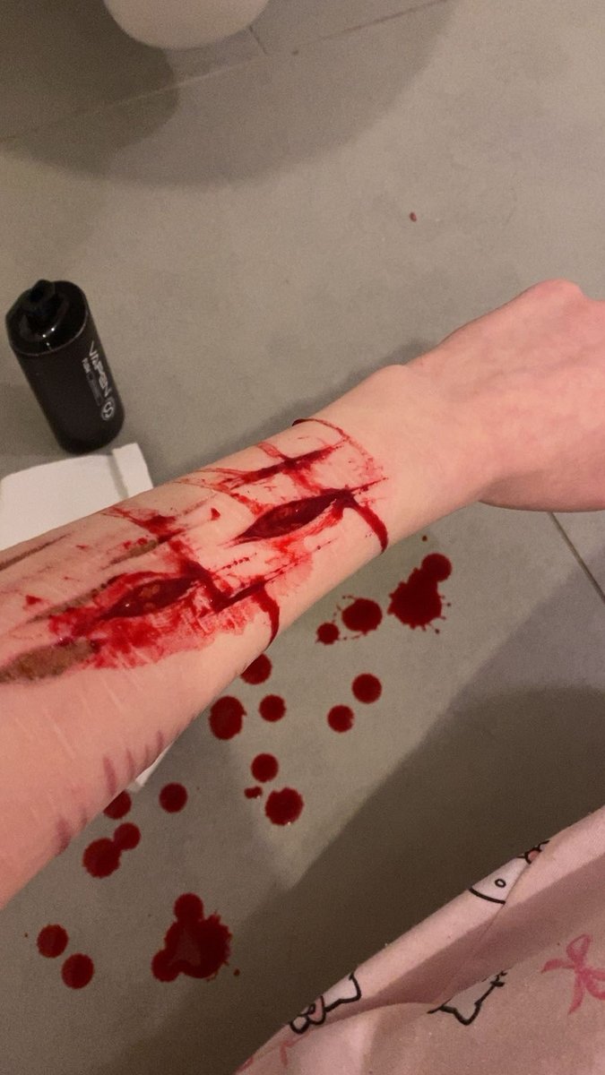 famous_prophett's tweet photo. IM SO SORRY YOU CANT SEE THE FIRST ONE THAT WELL ON THE VID #shtwt #selfharm #shedtwt #beanspo #beans #beanshtwt #slittwt https://t.co/pwQsz9cKIB
