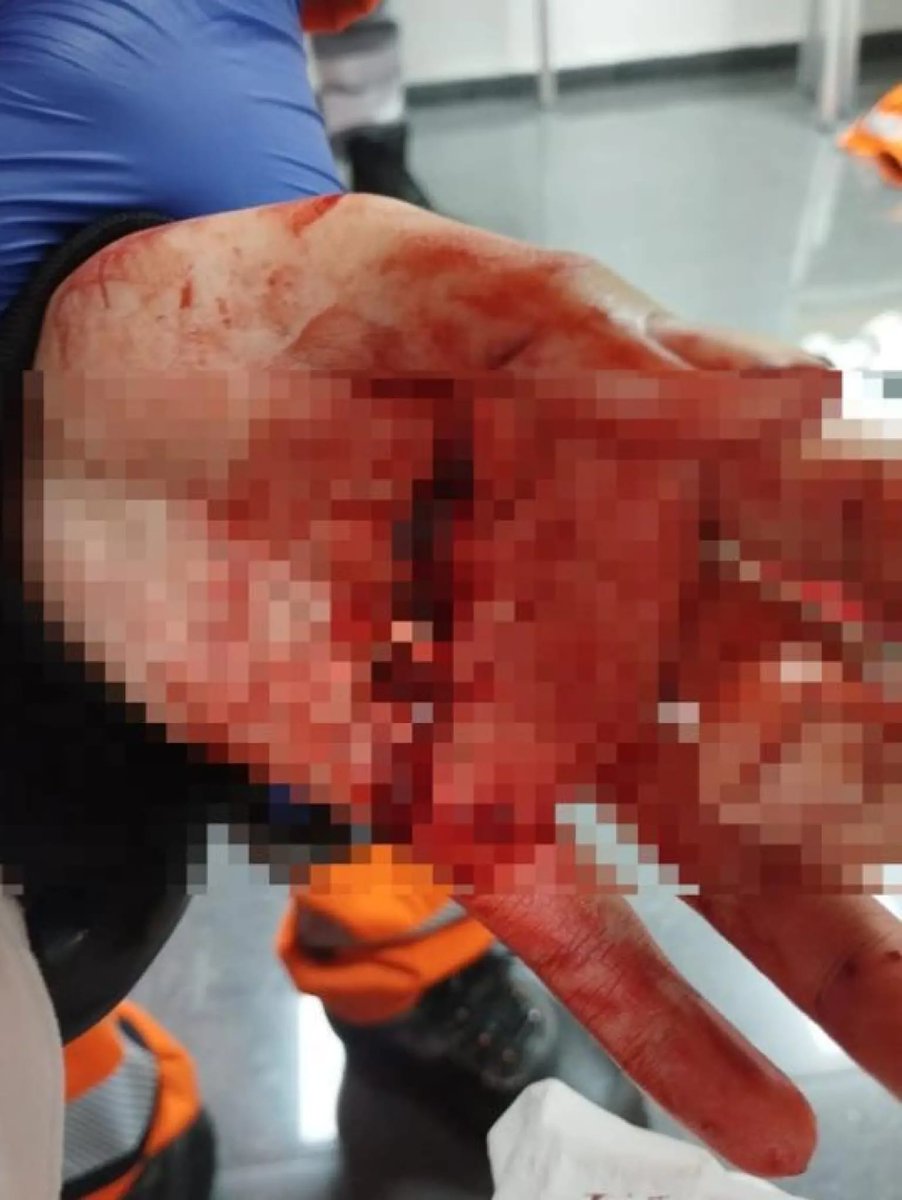 Ataque a machetazos en la estación de Vall d'Hebron del metro de Barcelona.

La víctima entró en la estación intentando huir de varios individuos armados con machetes, un tipo de agresión cada vez más habitual en España y que muestra la decadencia de nuestra sociedad.