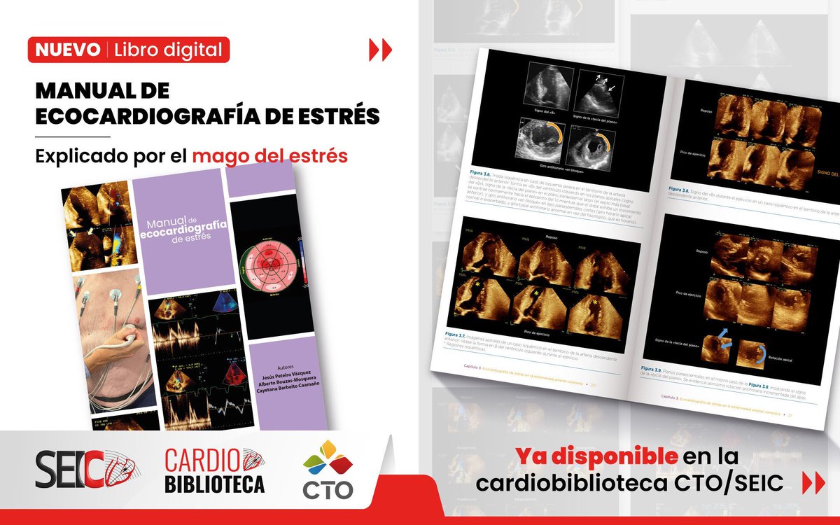 SEIC - Sociedad Española de Imagen Cardíaca tweet media