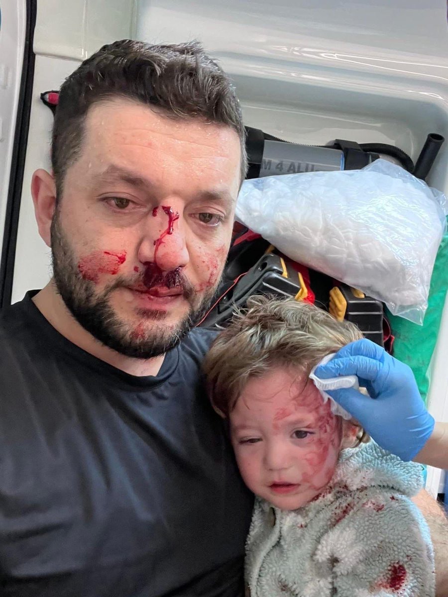 Yalova'da kucağında küçük kızı olan babaya saldırıp bu hale getirmişler.

Babanın burnu kırılmış, 14 aylık bebeğin ise kafatasında çatlak oluşmuş.

Benim bütün mücadelem, hiçbir babanın çocuğuyla bu duruma düşmemesi içindir.

Aile babalarının elini kolunu bağladığınız zaman daha