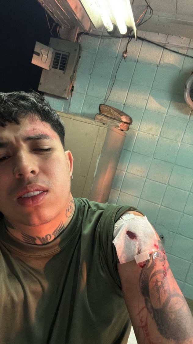 🚨🇲🇽:Imagen filtrada de un soldado herido en el brazo durante una operación encubierta contra Mencho. La fotografía habría sido tomada después de un enfrentamiento.