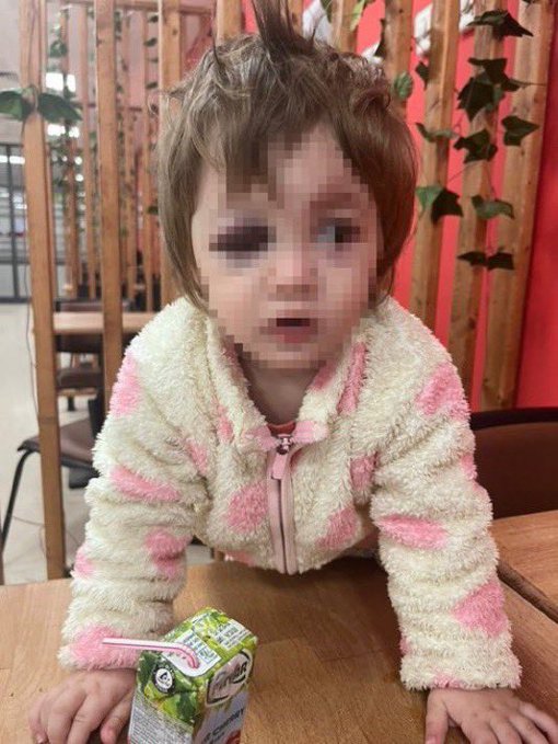 Yalova’da iftar için 14 aylık kızıyla pide kuyruğunda bekleyen Ahmet Baca, ‘Ne bakıyorsun’ diyen Ş.E. tarafından saldırıya uğradı.

Feci şekilde darbedilen Ahmet Baca’nın burnu, küçük kızının ise kafatası kırıldı. 

Darp edilen baba M.B:
▫️Vanlılarmış, aşiret çocuklarıymış.