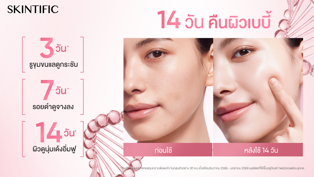 ใหม่! มอยส์ PDRN — ที่สุดของนวัตกรรมมอยเจอร์ไรเซอร์จาก SKINTIFIC 🩷✨

บำรุงผิวระดับพรีเมียมด้วย SKINTIFIC PDRN Bright &amp; Smooth Moisture Gel มอยเจอร์ไรเซอร์ที่ประกอบไปด้วย PDRN ความเข้มข้นสูงผสานกับสารสกัดบำรุงผิว ช่วยฟื้นฟูและซ่อมแซมผิวจากภายใน