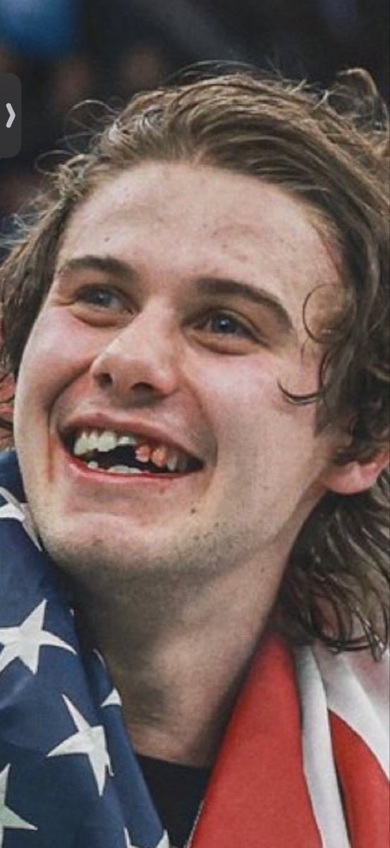 I want a Senate Leader that looks like this after fighting the Left.