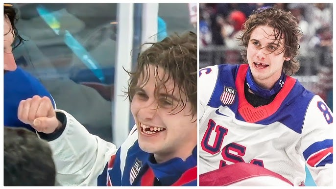 If Lebron had his teeth knocked out, he'd take the rest of the season off.

Jack Hughes stayed in the game, won it in overtime, and then thanked the United States military for their support.