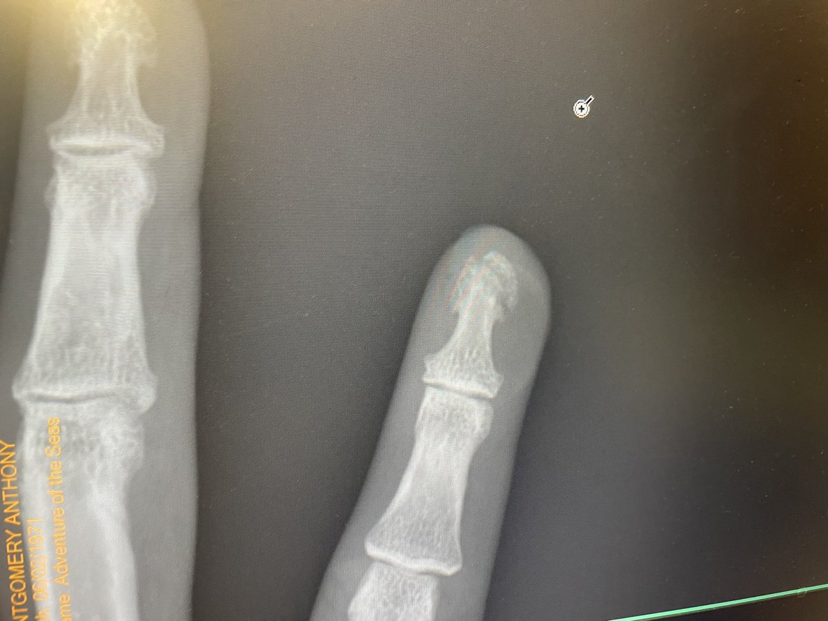 Anthony Montgomery tweet media