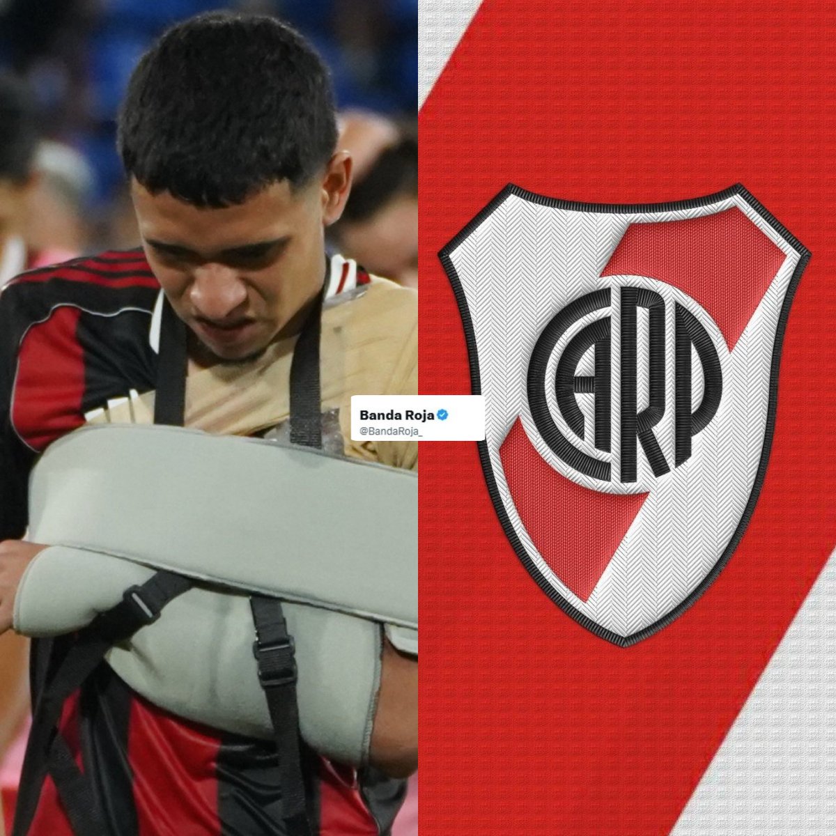 🚨PREOCUPA LA LESION DE KENDRY PÁEZ.

🏥 El primer parte médico de #River: Esguince acromioclavicular izquierdo

⁉️ ¿Qué tipo de lesión es?

🔸Es una lesión (distensión o desgarro) de los ligamentos que conectan la clavícula con el omóplato.
🔸Dependiendo del grado, el jugador