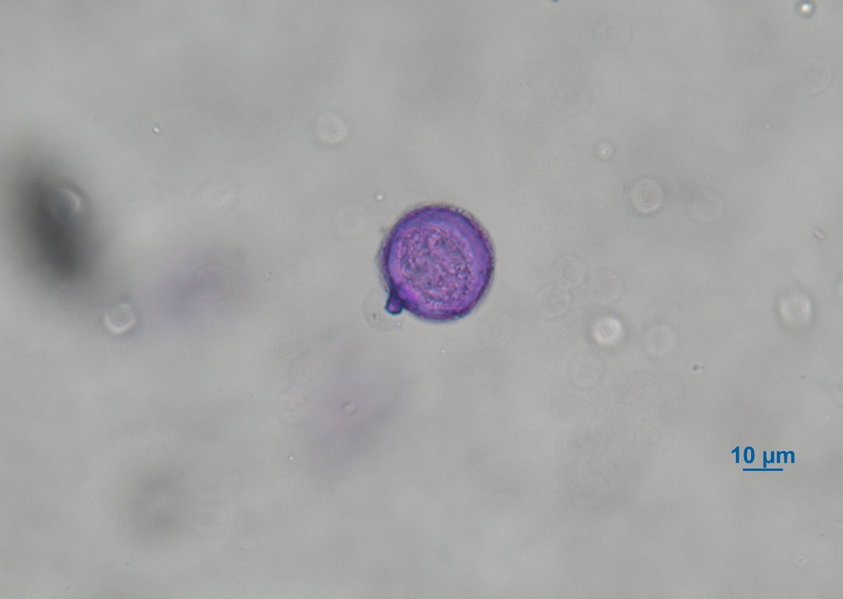 Pollen_Lab's tweet photo. 昨日は暖かい一日となりましたね。この陽気の影響で、スギ花粉の飛散が始まったようです。

先週の土曜日までは、長いパピラをもつスギ花粉は確認されず、メタセコイアやセコイアの花粉のみが飛散している状況でしたが、本日の観測ではスギ花粉が確認されました。

https://t.co/RZz0Lnyd4m https://t.co/HdyiAs64dt