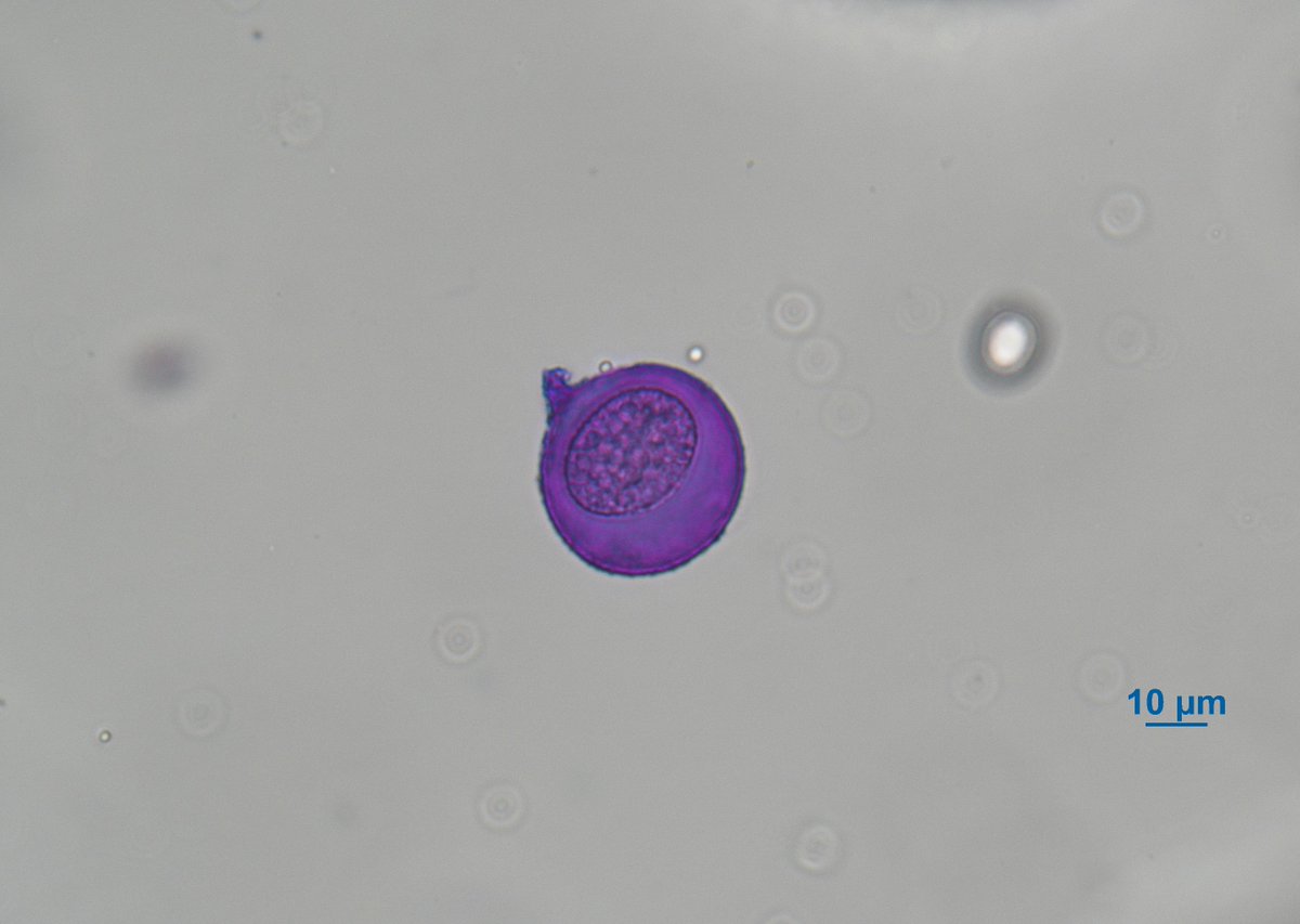 Pollen_Lab's tweet photo. 昨日は暖かい一日となりましたね。この陽気の影響で、スギ花粉の飛散が始まったようです。

先週の土曜日までは、長いパピラをもつスギ花粉は確認されず、メタセコイアやセコイアの花粉のみが飛散している状況でしたが、本日の観測ではスギ花粉が確認されました。

https://t.co/RZz0Lnyd4m https://t.co/HdyiAs64dt