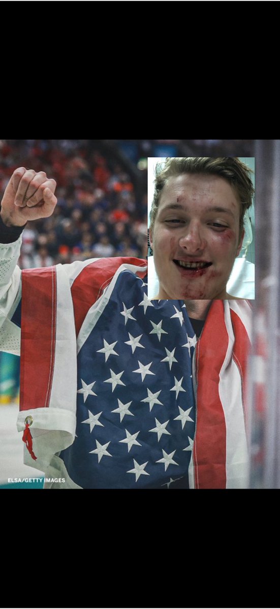 Jake Lanning tweet media