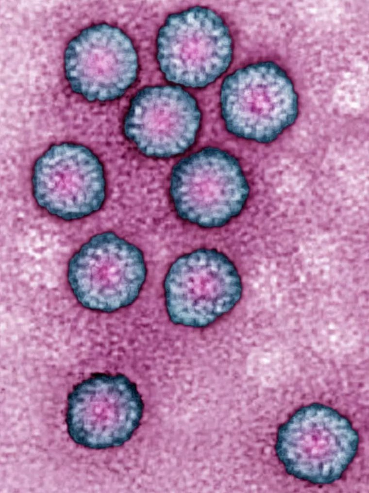 BLACKPINK as STD’s, a thread 🧵 💗