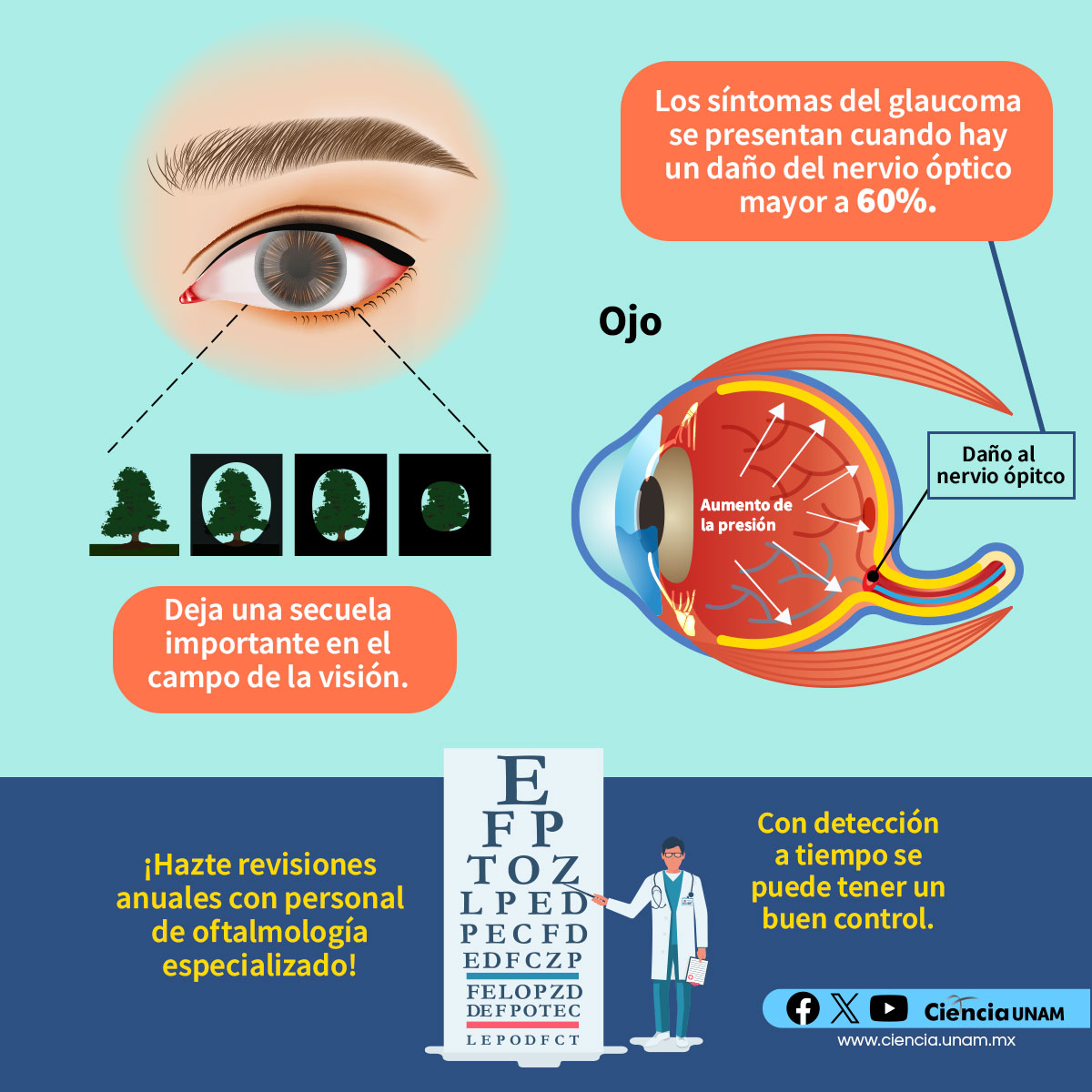 Ciencia_UNAM's tweet image. #Salud | El #glaucoma es una causa de #ceguera #reversible y #prevenible, lamentablemente si las personas no se atienden a tiempo pueden perder la vista 😞
lc.cx/U6oDxq