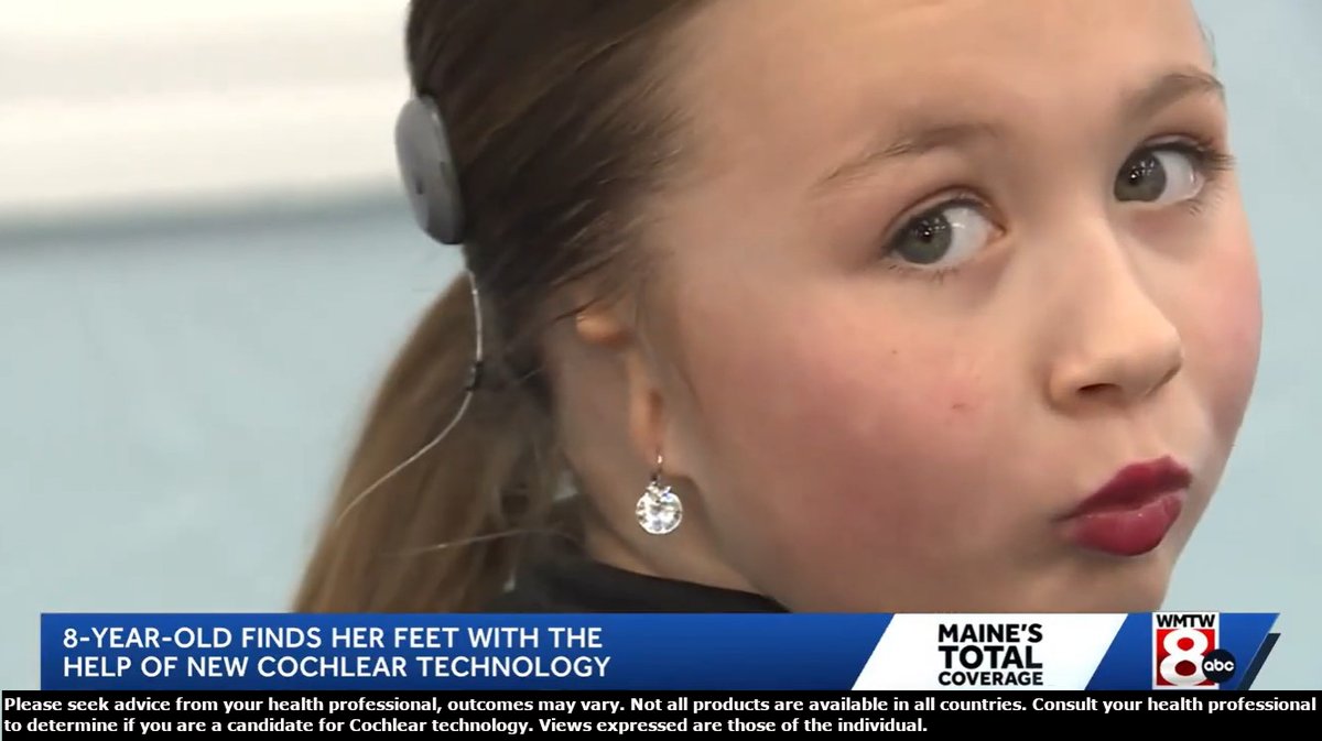 Cochlear Americas tweet media