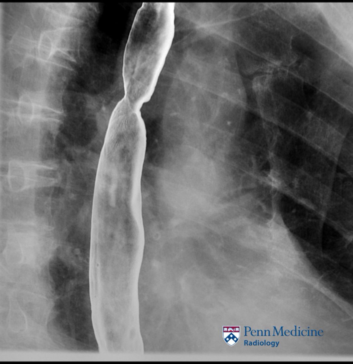 AuntMinnie.com tweet media