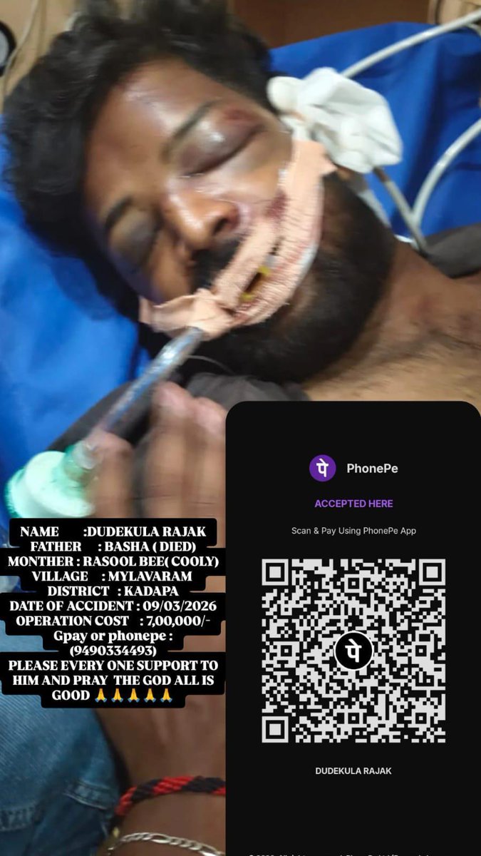 Na friend valla Friend 
His name is Jillan met with an accident 

Name : Dudekula Rajak (Brother) 
Village: MylavaramDam,Kadapa Dist.
His father expired, Mother is a daily wager 
Need 7Lakhs for operation 

Please need your help sir <a href="/SonuSood/">sonu sood</a>
<a href="/SoodFoundation/">Sood Charity Foundation</a> 🙏🙏🙏