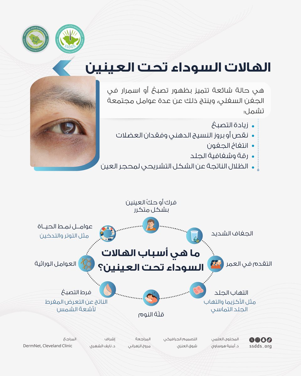 Saudi Society of Dermatology & Derm Surgery(SSDDS) tweet media
