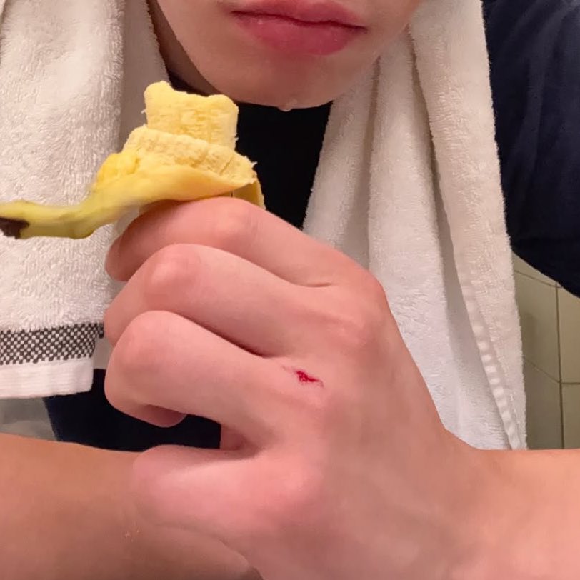 내 벤츠에……. 스크레치……. 아…….,,