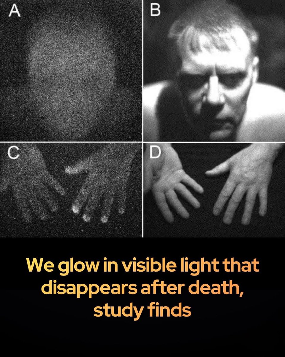 NextScience's tweet photo. 🚨 Scientists have confirmed that all living things glow with a faint light…until they die. 

Your body is glowing right now, though not in a way the human eye can see. Using ultra-sensitive imaging technology, researchers from the University of Calgary and Canada’s National Research Council have successfully captured "ultraweak photon emission"—a faint, visible light produced by living organisms. By observing mice in total darkness, the team discovered that living tissue radiates significantly more photons than dead tissue, proving that this glow is a direct byproduct of biological life. Unlike body heat, which is infrared radiation, these emissions are in the visible spectrum and originate from the chemical reactions occurring within our cells.

This biological light is fueled by reactive oxygen species created during normal metabolism. When these molecules interact with proteins and lipids, they release tiny bursts of energy in the form of light. The study found that this glow intensifies under physical stress; injured plants, for instance, emitted much brighter signals. This discovery offers a revolutionary path for future medical diagnostics. Since the intensity of the light reflects the level of oxidative stress and metabolic activity, scientists believe these invisible signals could eventually serve as non-invasive markers for monitoring organ vitality, disease progression, and overall health.

source: University of Calgary & National Research Council of Canada. (2025). Imaging Ultraweak Photon Emission from Living and Dead Mice and from Plants under Stress. The Journal of Physical Chemistry Letters.