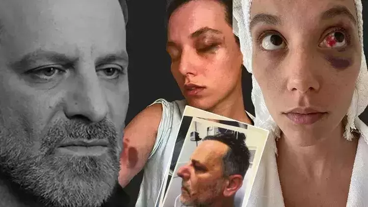 ozan güven, bir kavga anında bir kadına bunu yapmış birisi. mahkeme kararı ile de sabit. hatta temyizle de sabit. bu adama gösterdiğiniz hoşgörü neden hemcinslerim? siz kavga etmediniz mi hiç? hepiniz mi kadınlara böyle davrandı da olayı şahsi almıyorsunuz?