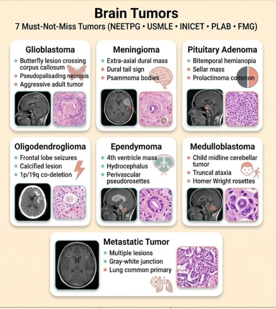 Brain Tumors