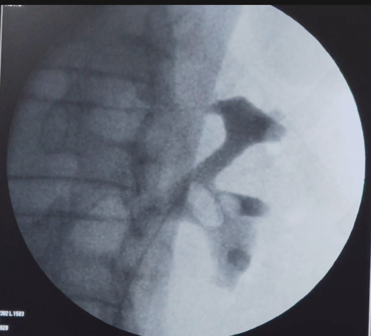 Dr Chandra Mohan Vaddi tweet media