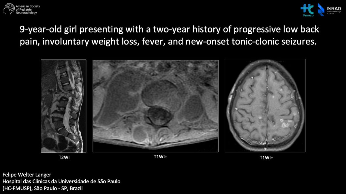 American Society of Pediatric Neuroradiology tweet media