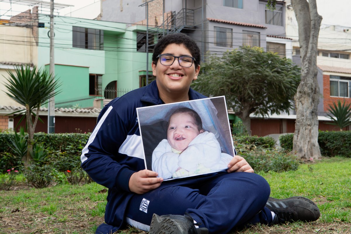 Smile Train tweet media