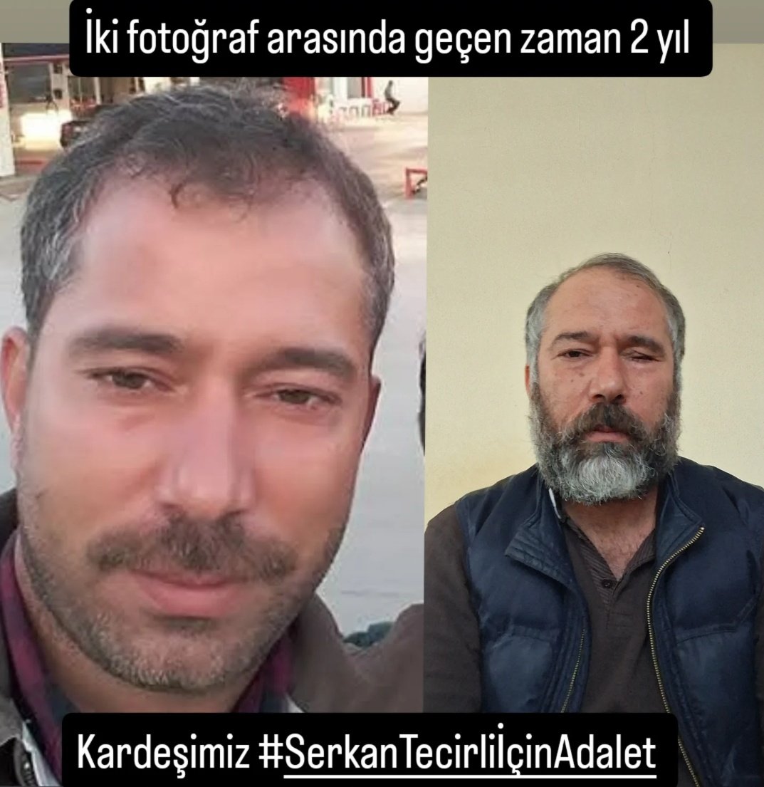 Hiçbir husumetinin olmadığı aşiret mensubu Mesut Yağmurcu tarafından,  
"küfür etmeyin" dediği için, kafasında kırılan bardak gözüne sokularak kör edilen kardeşim Serkan Tecirli'nin, yarın sabah saat 09.20 de Adana adliyesinde karar duruşması var. 

Kardeşimin kör edildiği 17