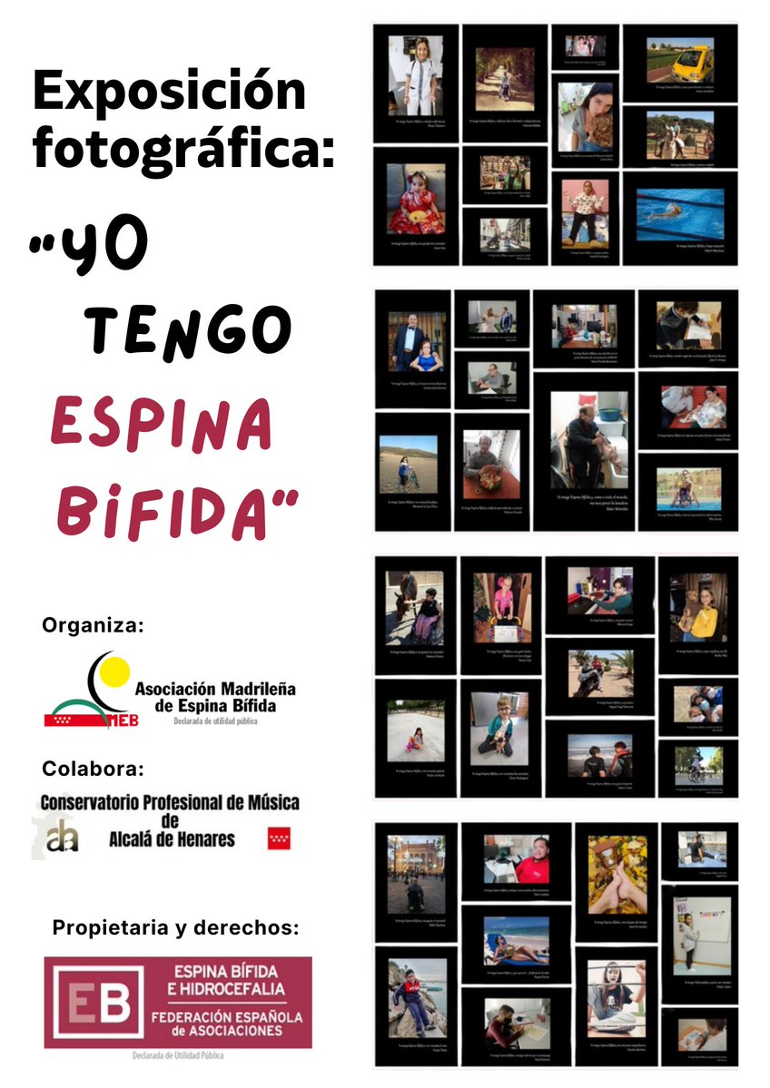 AMEB Espina Bífida tweet media