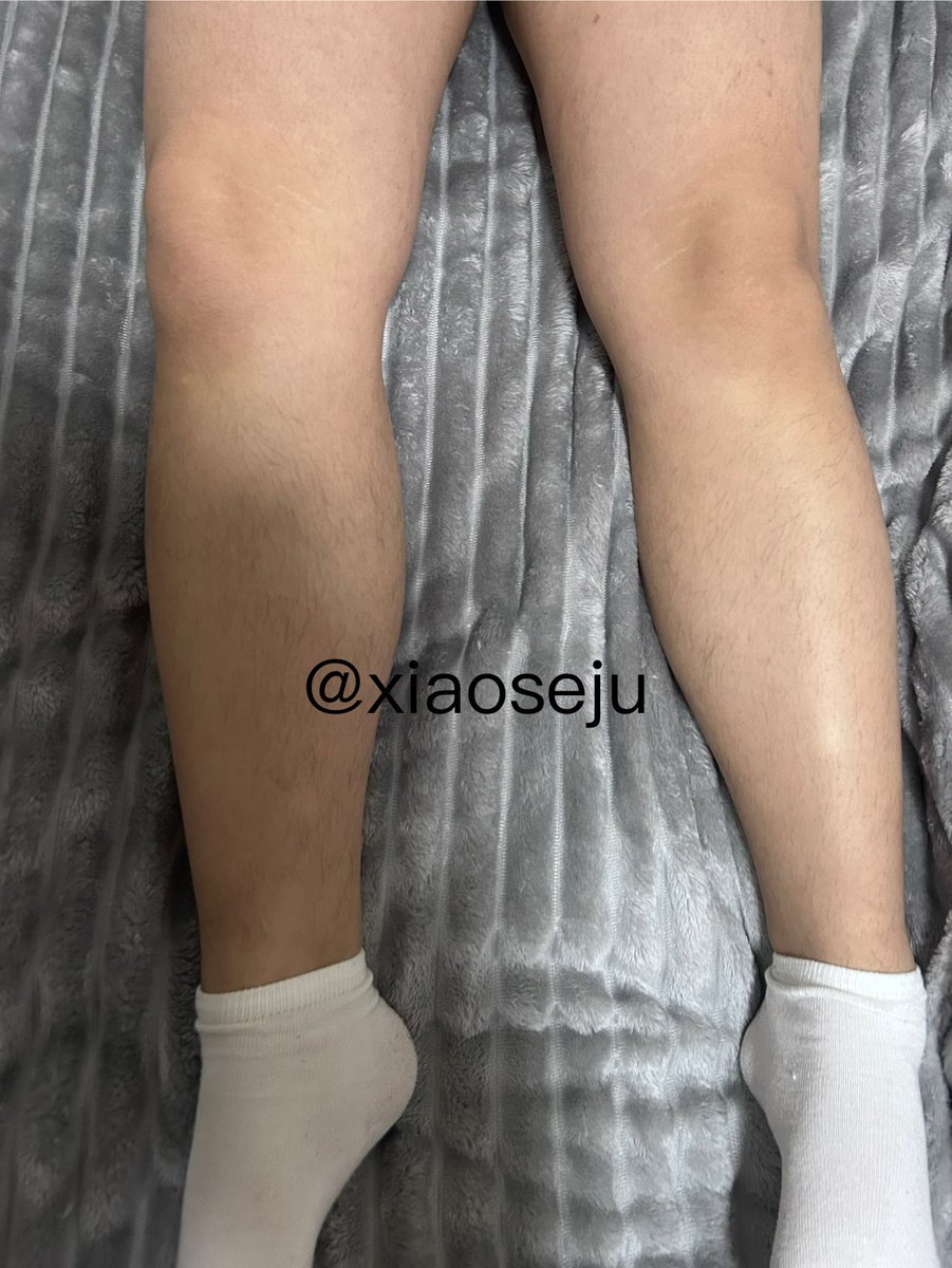 xiaoseju's tweet photo. #男士脱毛 #南昌脱毛 https://t.co/N2zJjgWnzW