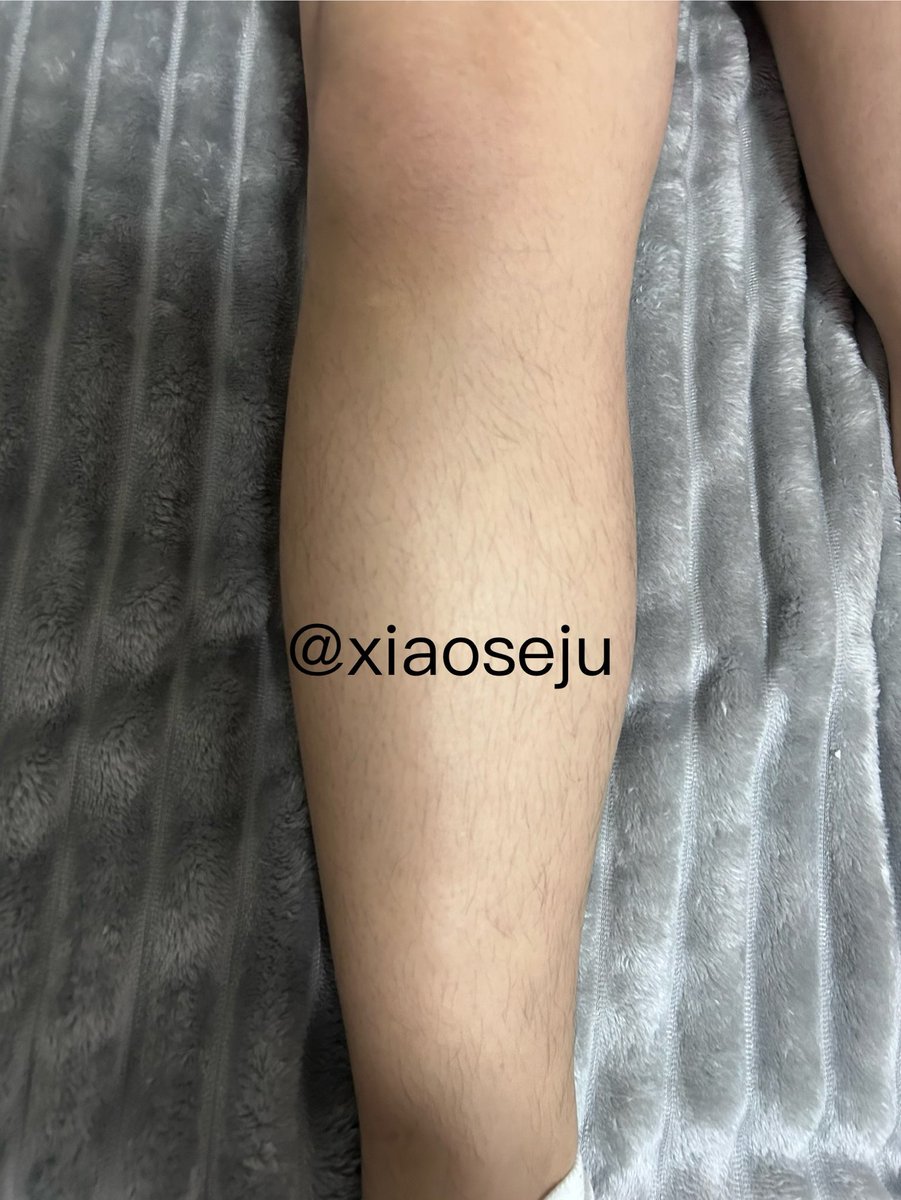xiaoseju's tweet photo. #男士脱毛 #南昌脱毛 https://t.co/N2zJjgWnzW
