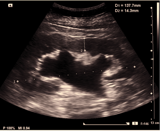POCUSAcademy's tweet photo. Our case of the week has been posted! Follow us on LinkedIn, Instagram, or Facebook to review the case + share your answer.
LinkedIn: https://t.co/5lOcVHhCUx
Instagram: https://t.co/mAXW4a5Ljv
Facebook: https://t.co/kYeuFMzmoT
#POCUSCaseStudyChallenge https://t.co/osVg2x5F1I