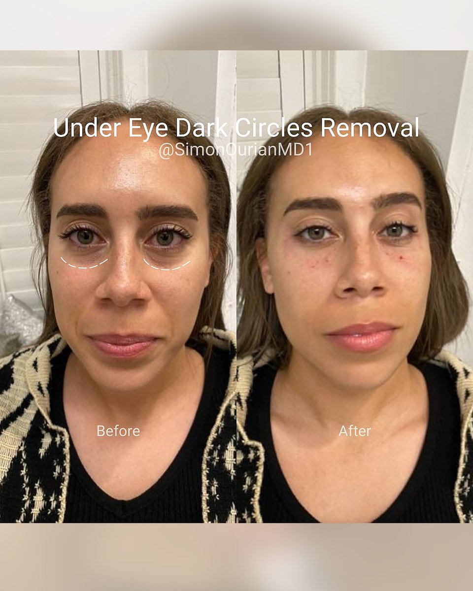 Dr. Simon Ourian - Epione tweet media