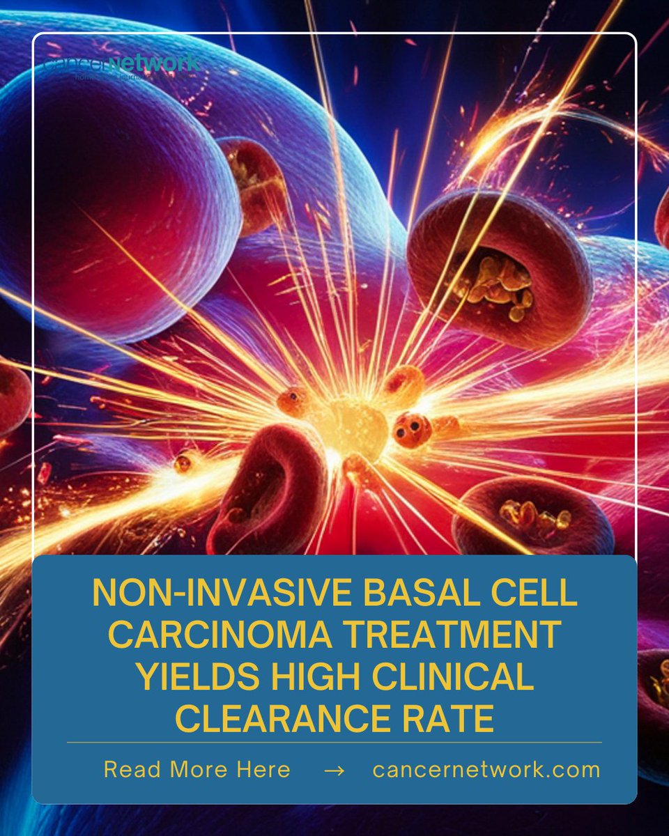 CancerNetwrk's tweet image. A high clinical clearance rate was observed with doxorubicin microneedle array as a non-invasive way to treat basal cell carcinoma of the skin.

hubs.li/Q045X2ZV0

#skcsm #SkinCancer #Oncology