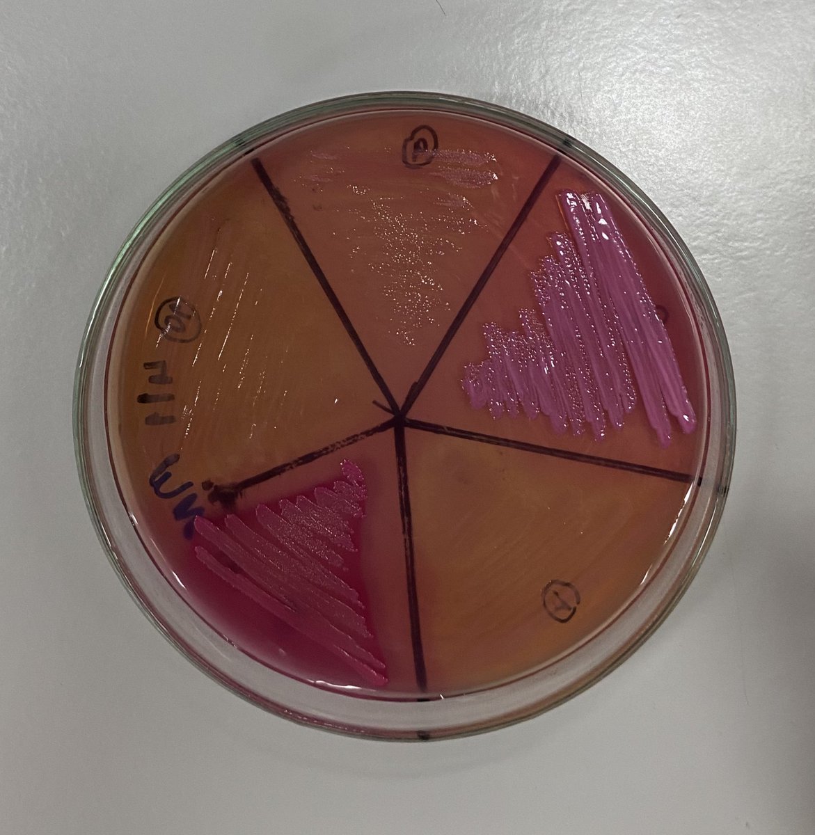iknowasyouknow's tweet photo. biochem test รอบที่ n https://t.co/0GLFSyJGRw