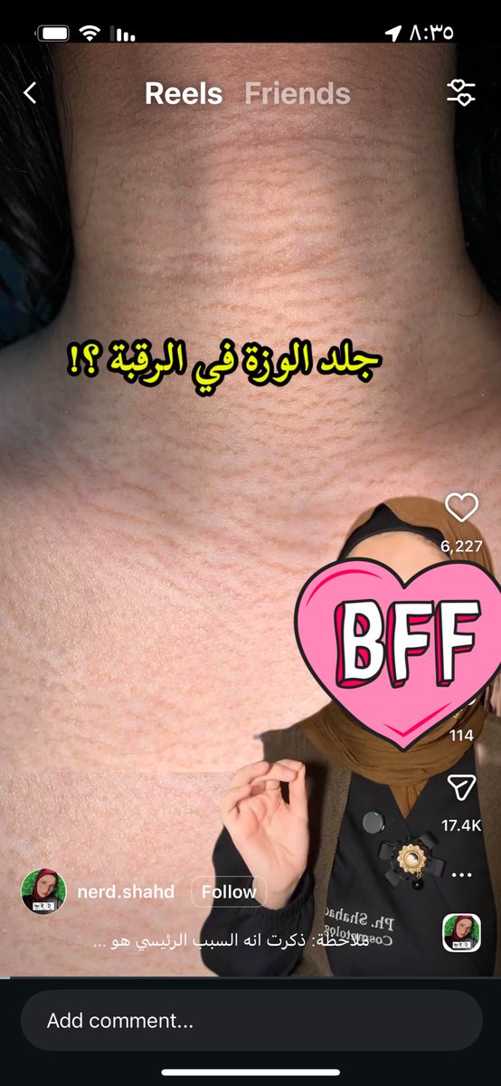 حبحب tweet media