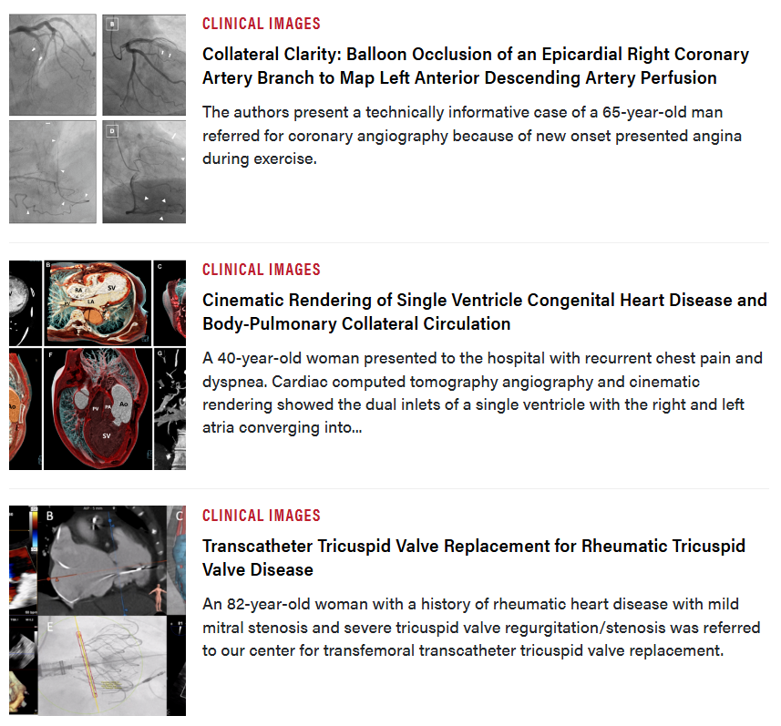 Journal of Invasive Cardiology tweet media