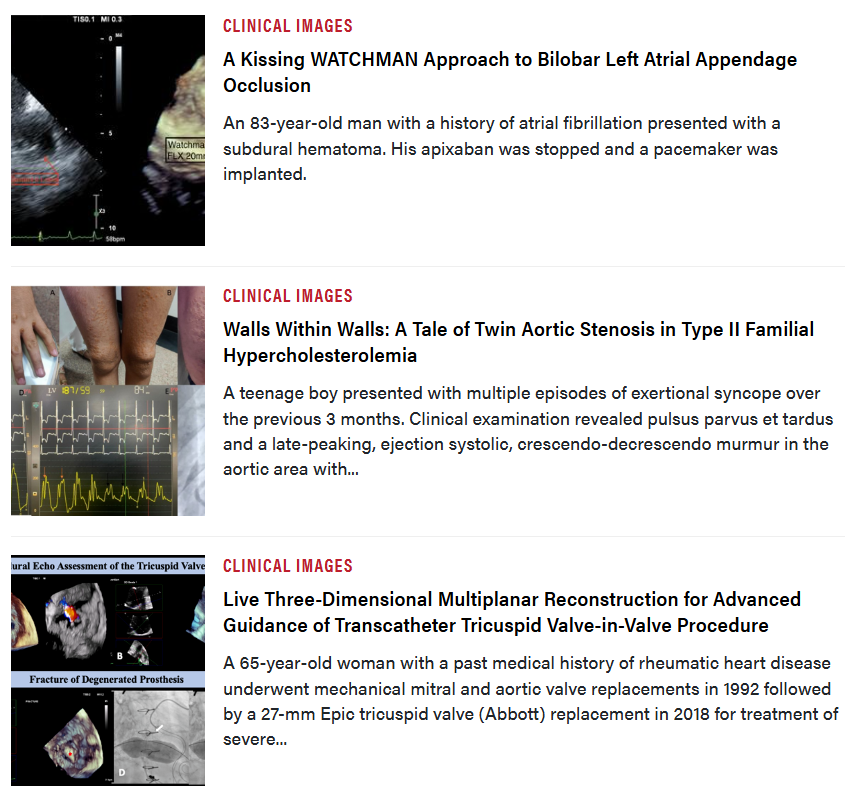 Journal of Invasive Cardiology tweet media
