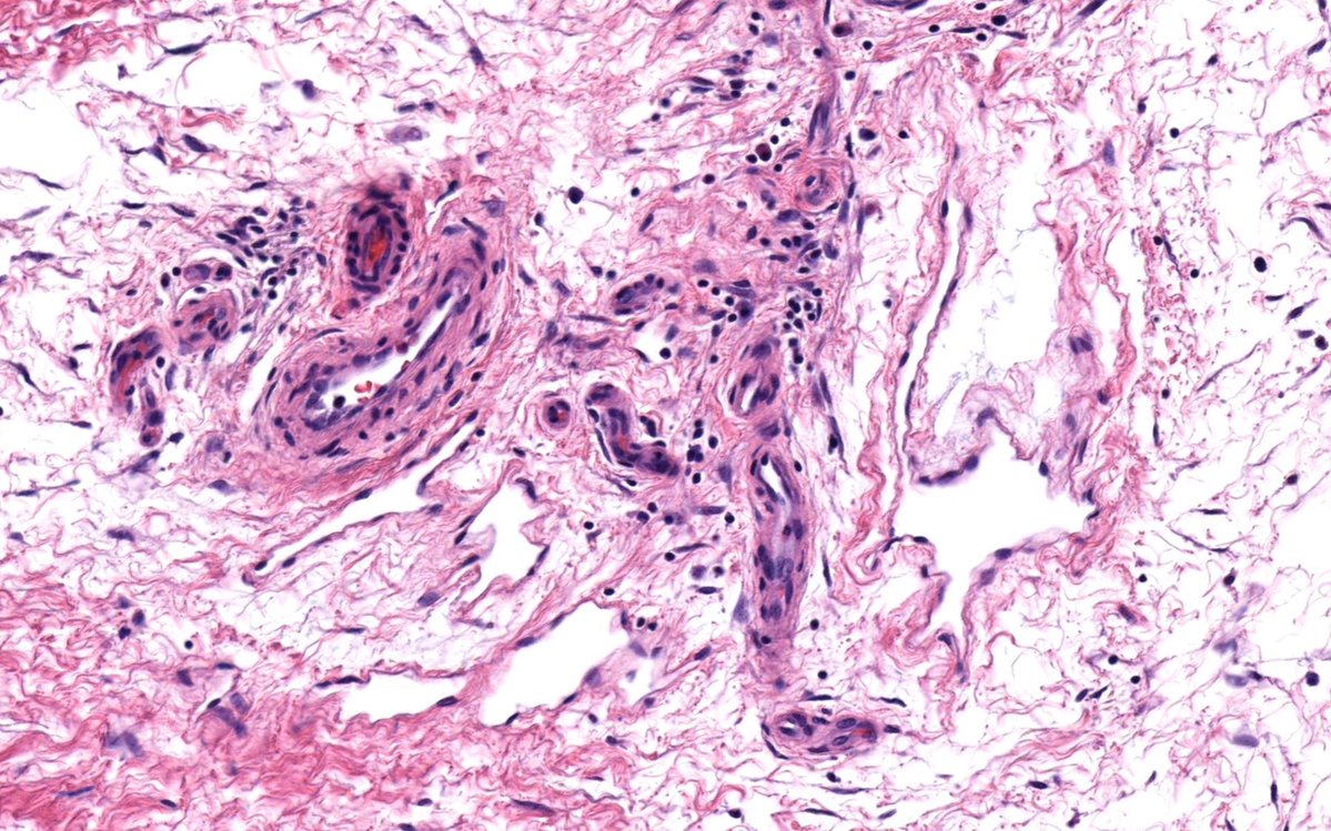 Jerad Gardner, MD tweet media