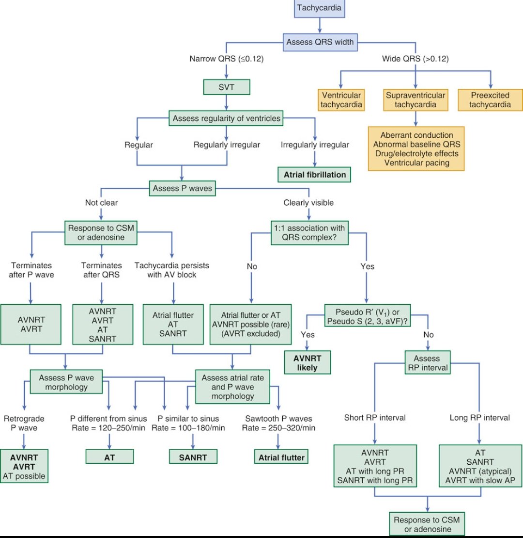 TrackYourHeart's tweet photo. Stepwise approach to diagnosis of the type of tachycardia based on a 12-lead electrocardiogram during the episode. https://t.co/Usczfh4Q2J