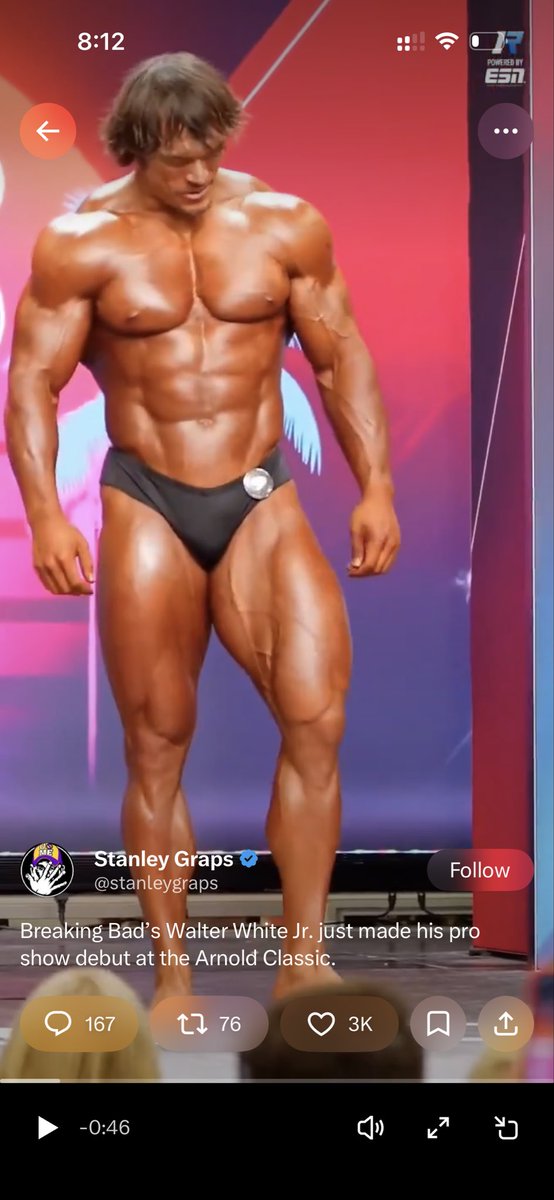 Ronit_ai's tweet photo. @stanleygraps @grok cover him in full clothes and than imagine his body. https://t.co/4b6JMAPkvL