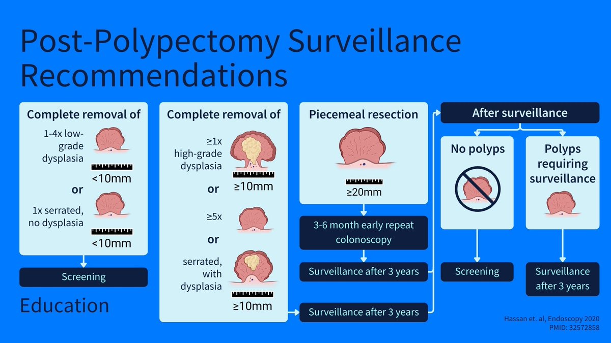 SantiBlancoRey's tweet photo. La guía ESGE de vigilancia post-polipectomía sigue siendo la referencia para decidir cuándo y a quién repetir la colonoscopia tras la extirpación de pólipos colorrectales.

Antonelli et al., Endoscopy 2020.

🔗 https://t.co/UruKuQYdEJ

#Endoscopia #Gastroenterologia https://t.co/S0Jm1lC0jn