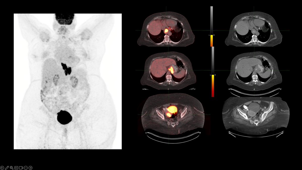 Nuclear MD tweet media